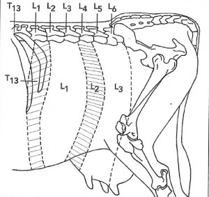 Figure 17 : Régions du flanc anesthésiées après une anesthésie paravertébrale proximale ou distale – Référence bibliographique n°4, page 11