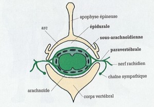 Rappel anatomique et dénomination des différentes injections intrarachidiennes