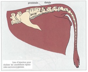 epidurale schéma anat^2