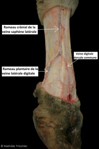 post vu face latérale annoté