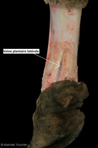 post vue plantaire latérale annoté